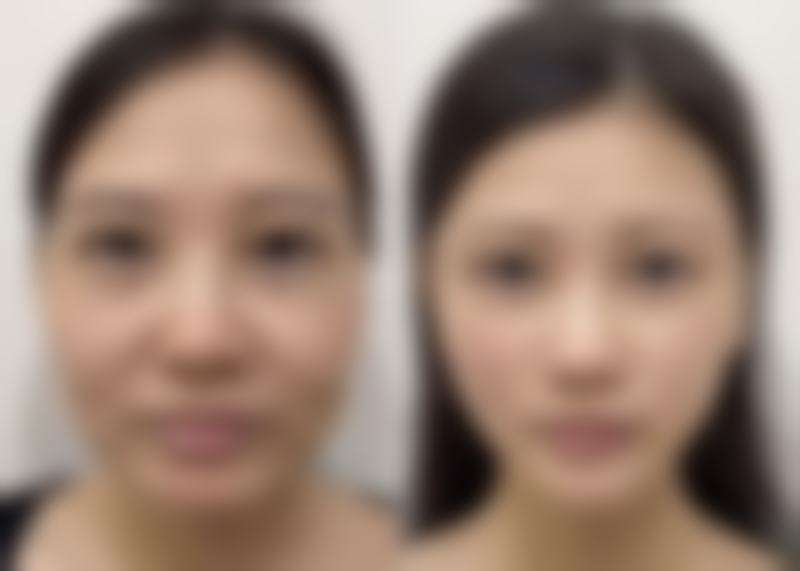 德阳熙之堂医疗美容诊所医院口碑评价